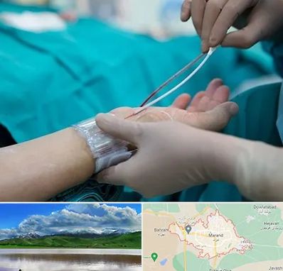 آنژیوگرافی در مرند