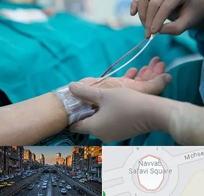 آنژیوگرافی در نواب