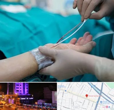 آنژیوگرافی در آبرسان تبریز