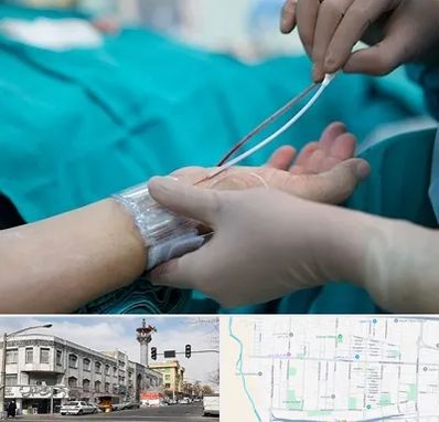 آنژیوگرافی در 17شهریور