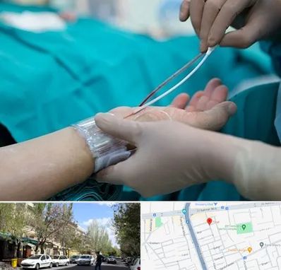 آنژیوگرافی در کوی فیروز تبریز