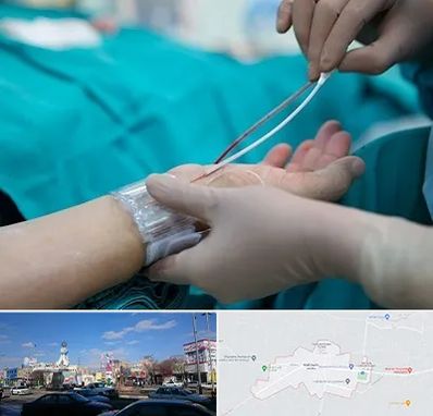 آنژیوگرافی در ماهدشت کرج