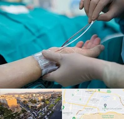 آنژیوگرافی در تهرانپارس 