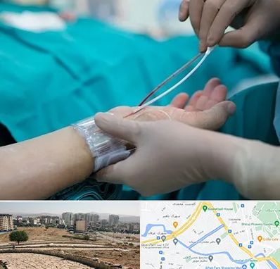 آنژیوگرافی در کوی وحدت شیراز