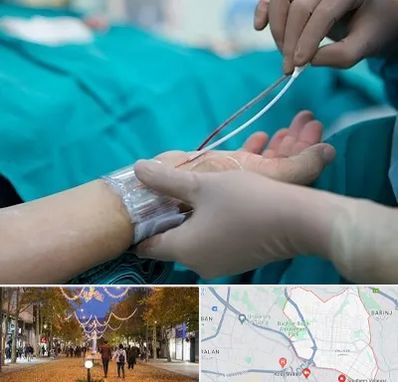 آنژیوگرافی در ولیعصر ارومیه