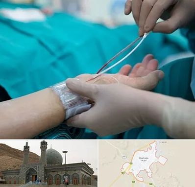 آنژیوگرافی در شهرضا