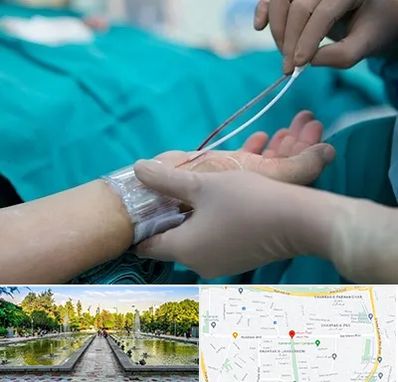 آنژیوگرافی در سرسبز