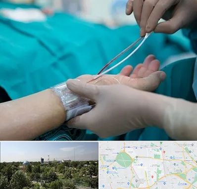 آنژیوگرافی در منطقه 16 تهران