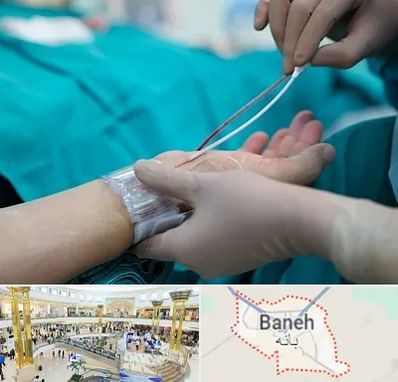 آنژیوگرافی در بانه