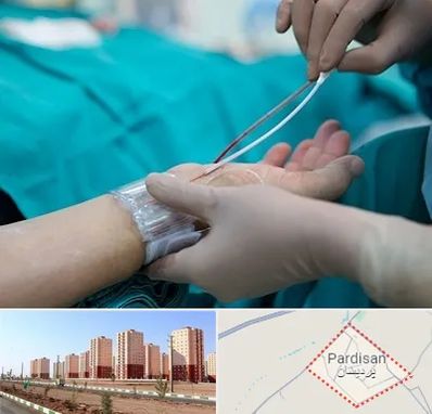 آنژیوگرافی در پردیسان قم