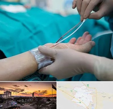 آنژیوگرافی در قوچان