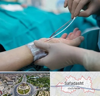 آنژیوگرافی در صفادشت