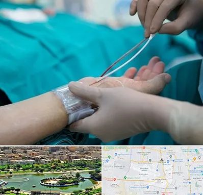 آنژیوگرافی در منطقه 9 تهران