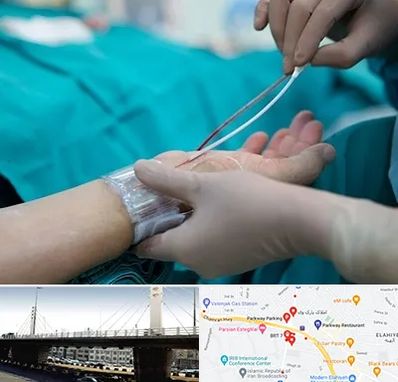 آنژیوگرافی در پارک وی 