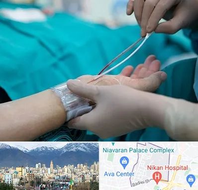 آنژیوگرافی در آجودانیه 