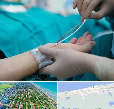 آنژیوگرافی در فریدونکنار