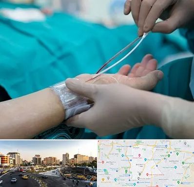 آنژیوگرافی در منطقه 7 تهران