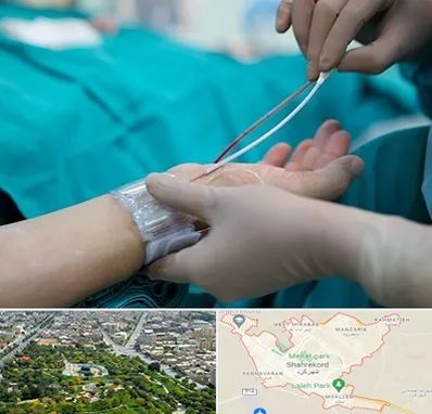 آنژیوگرافی در شهرکرد