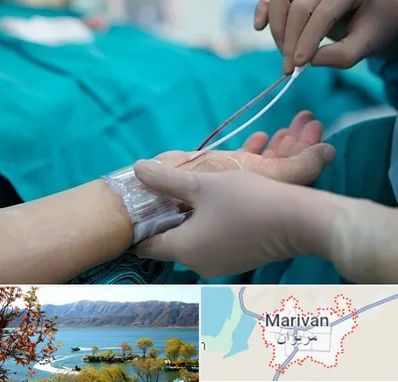 آنژیوگرافی در مریوان