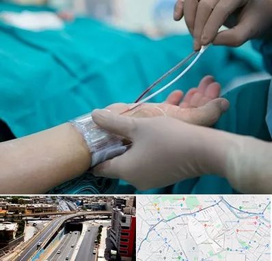 آنژیوگرافی در ستارخان شیراز