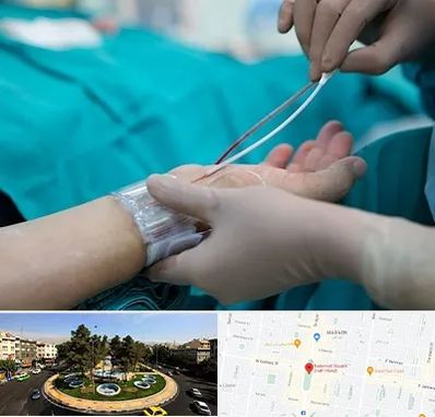 آنژیوگرافی در هفت حوض