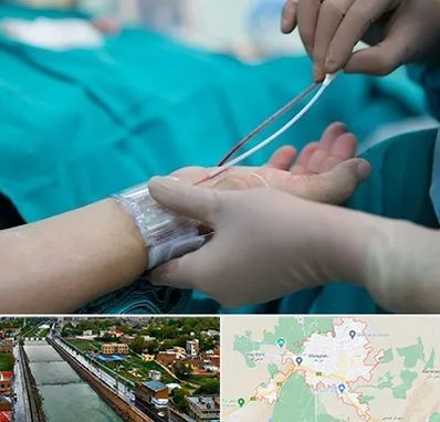 آنژیوگرافی در مراغه