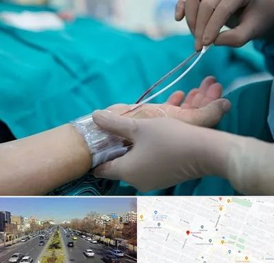 آنژیوگرافی در بلوار معلم مشهد