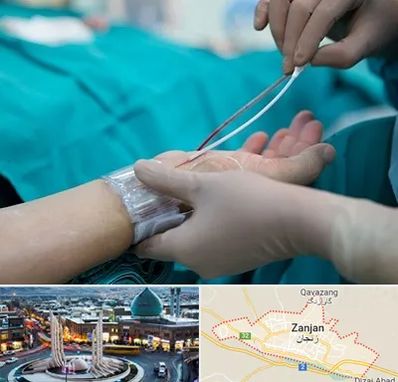 آنژیوگرافی در زنجان