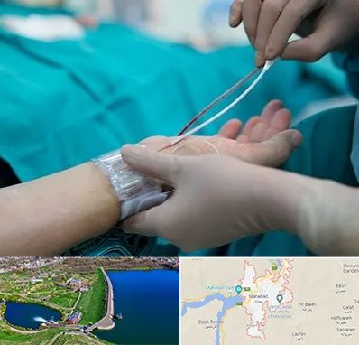 آنژیوگرافی در مهاباد