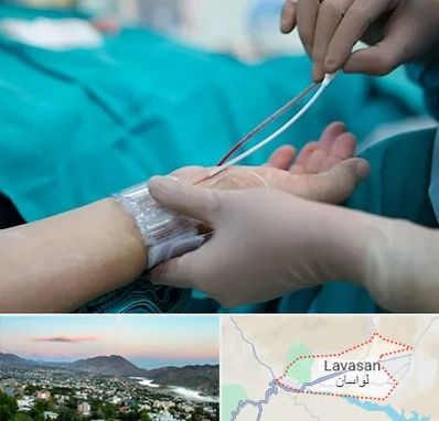 آنژیوگرافی در لواسان