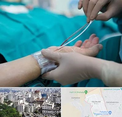 آنژیوگرافی در ولنجک 