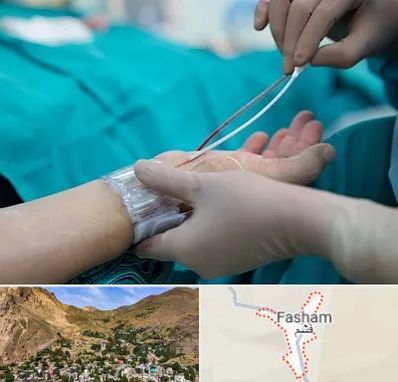 آنژیوگرافی در فشم