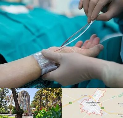 آنژیوگرافی در نیشابور