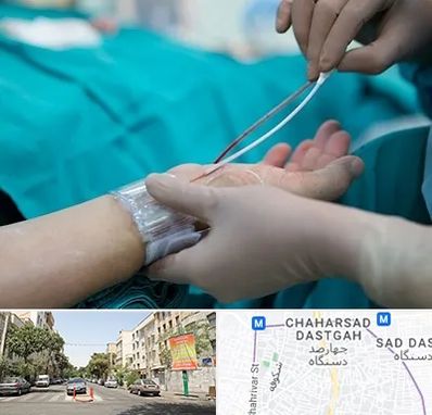 آنژیوگرافی در چهارصد دستگاه 