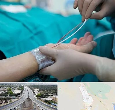 آنژیوگرافی در اندیمشک