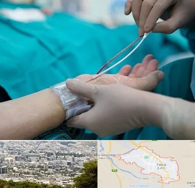 آنژیوگرافی در یاسوج