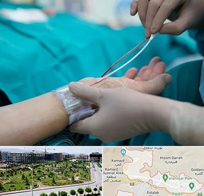 آنژیوگرافی در پردیس