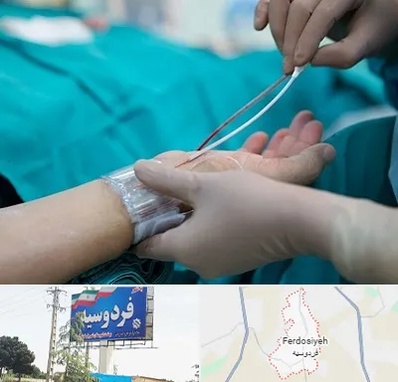 آنژیوگرافی در فردوسیه شهریار