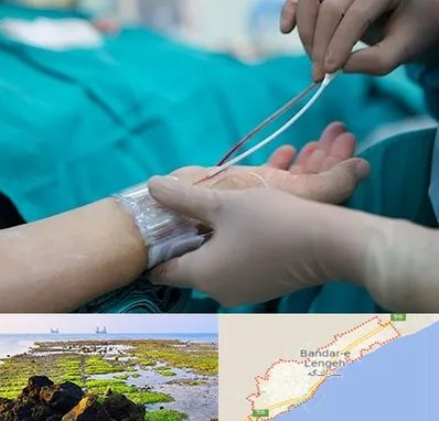 آنژیوگرافی در بندرلنگه