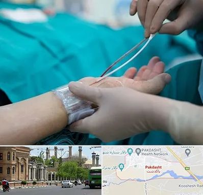 آنژیوگرافی در پاکدشت