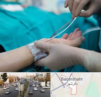 آنژیوگرافی در باقرشهر