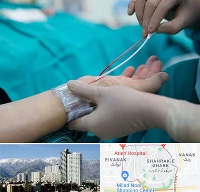 آنژیوگرافی در شهرک غرب 