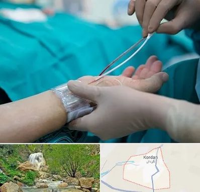 آنژیوگرافی در کردان