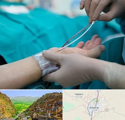 آنژیوگرافی در کامیاران