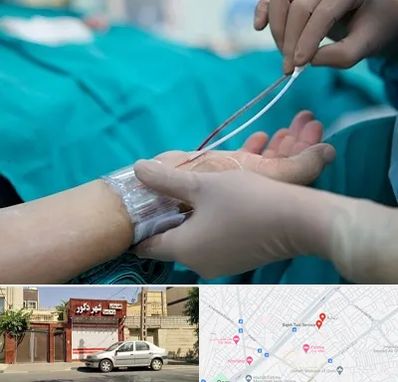 آنژیوگرافی در باجک قم