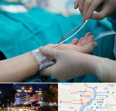 آنژیوگرافی در کیانپارس اهواز