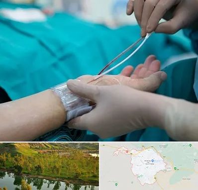 آنژیوگرافی در بهبهان