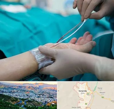 آنژیوگرافی در سنندج