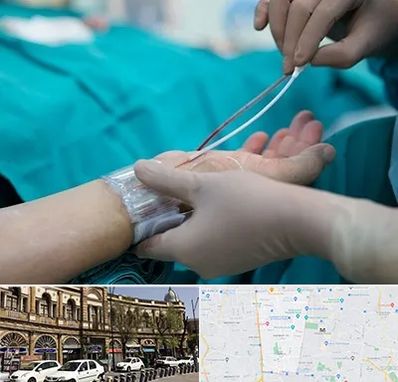 آنژیوگرافی در منطقه 11 تهران