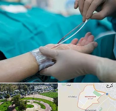 آنژیوگرافی در مهرشهر کرج 